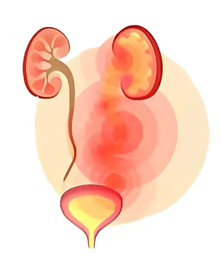 Urinary Tract Infections