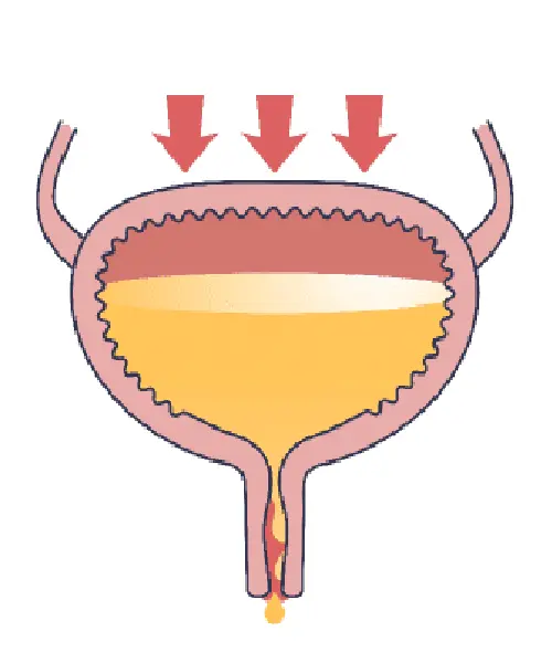 A Comprehensive Guide to Managing Incontinence