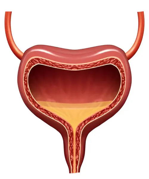 Overactive Bladder: Managing the Urge for a Balanced Life